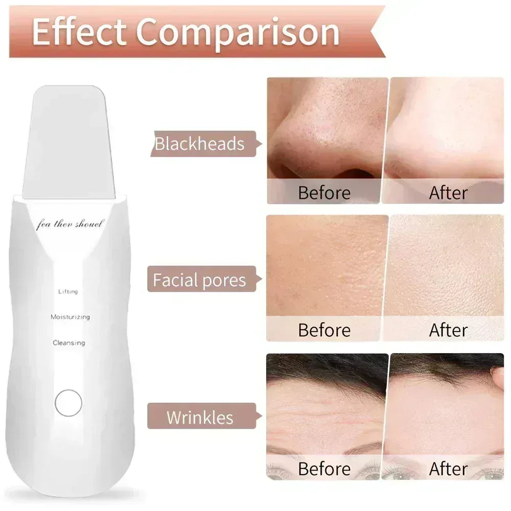 FawaQa | Leather Shovel Ultrasonic Facial Moisturizing Scrubber - FawaQa